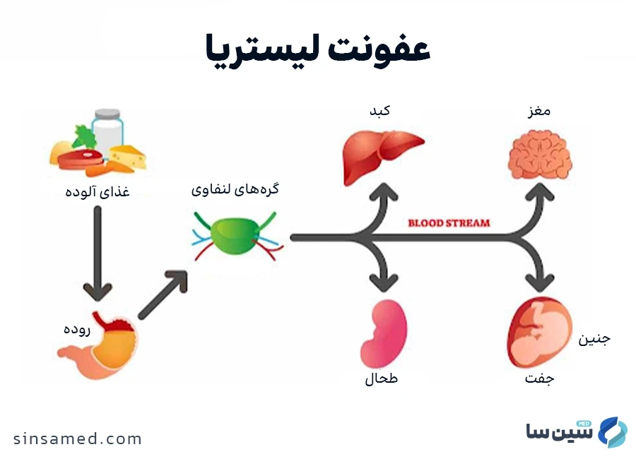 تاثیر عفونت لیستریا (لیستریوز) بر قسمت های مختلف بدن