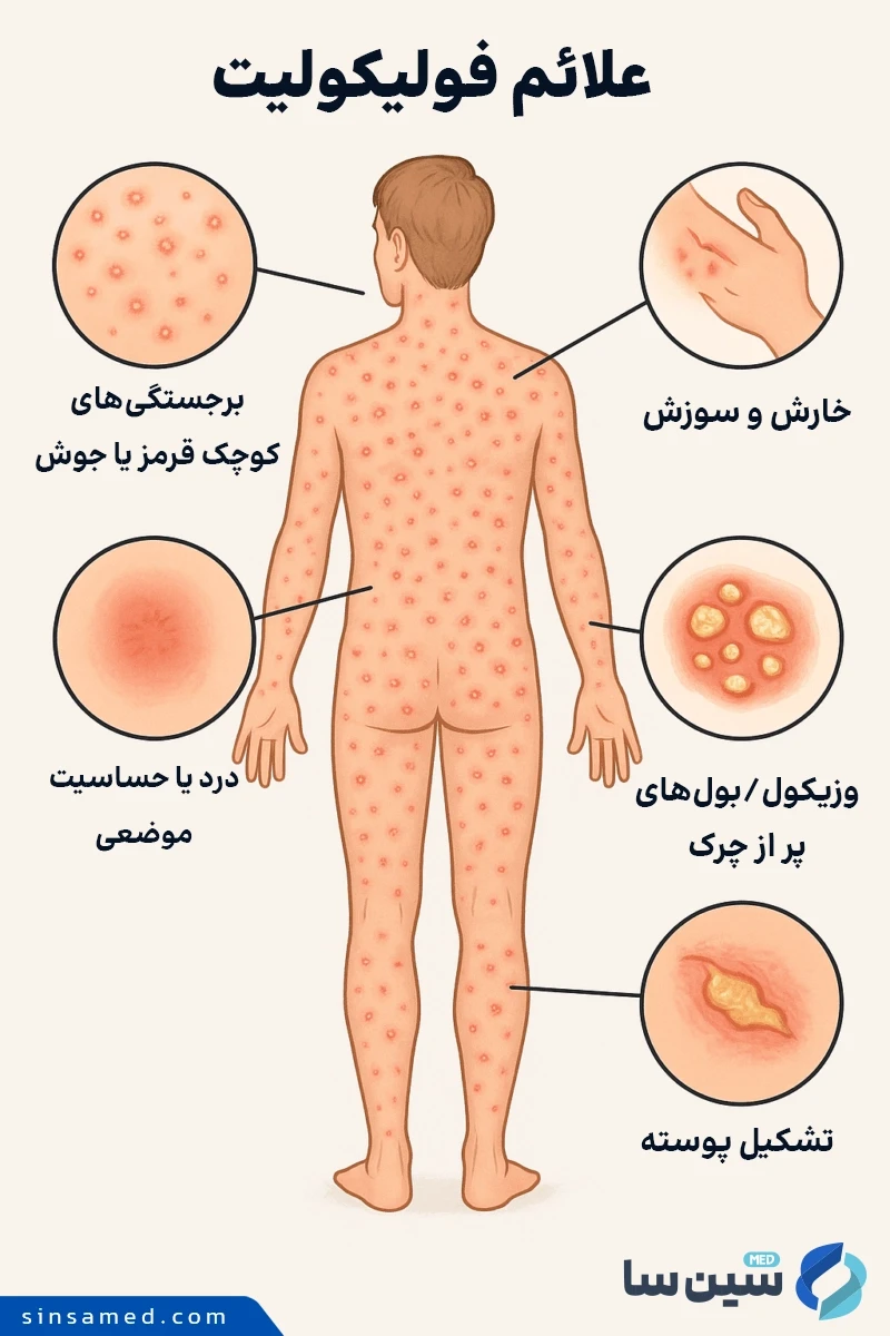 علائم التهاب فولیکول (فولیکولیت)