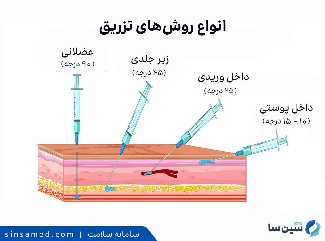 انواع روش های تزریق